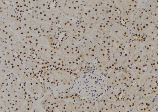 GTF2H4 / TFB2 Antibody - 1:100 staining rat kidney tissue by IHC-P. The sample was formaldehyde fixed and a heat mediated antigen retrieval step in citrate buffer was performed. The sample was then blocked and incubated with the antibody for 1.5 hours at 22°C. An HRP conjugated goat anti-rabbit antibody was used as the secondary.