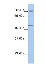 GTF2H4 / TFB2 Antibody - Fetal heart lysate. Antibody concentration: 1.0 ug/ml. Gel concentration: 12%.  This image was taken for the unconjugated form of this product. Other forms have not been tested.