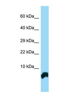 GTF2H5 Antibody - GTF2H5 antibody Western blot of Mouse Heart lysate. Antibody concentration 1 ug/ml.  This image was taken for the unconjugated form of this product. Other forms have not been tested.