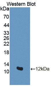 GTF2H5 Antibody - Western Blot; Sample: Recombinant protein.
