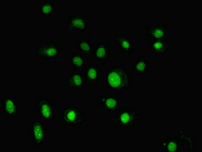 GTF2H5 Antibody - Immunofluorescent analysis of HepG2 cells using GTF2H5 Antibody at dilution of 1:100 and Alexa Fluor 488-congugated AffiniPure Goat Anti-Rabbit IgG(H+L)