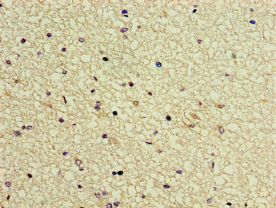 GTF2H5 Antibody - Immunohistochemistry of paraffin-embedded human brain tissue using GTF2H5 Antibody at dilution of 1:100
