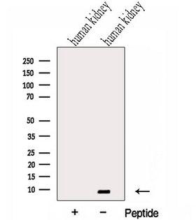 GTF2H5 Antibody - Western blot analysis of extracts of human kidney tissue using GTF2H5 antibody. The lane on the left was treated with blocking peptide.