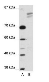 GTF2I / TFII I Antibody - A: Marker, B: HepG2 Cell Lysate.  This image was taken for the unconjugated form of this product. Other forms have not been tested.