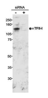 GTF2I / TFII I Antibody - Detection of Human GTF2I/TFII-I by Western Blot. Samples: Whole cell lysate (100 ug) from HEK293 cells treated with GTF2I/TFII-I siRNA (+) or untreated (-). Antibody: Affinity purified rabbit anti-GTF2I/TFII-I used at 0.2 ug/ml. Detection: Chemiluminescence.