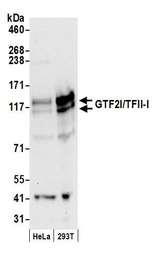 GTF2I / TFII I Antibody - Detection of human GTF2I/TFII-I by western blot. Samples: Whole cell lysate (50 µg) from HeLa and HEK293T cells prepared using NETN lysis buffer. Antibodies: Affinity purified rabbit anti-GTF2I/TFII-I antibody used for WB at 0.1 µg/ml. Detection: Chemiluminescence with an exposure time of 30 seconds.