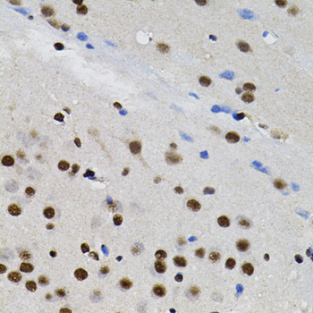 GTF2I / TFII I Antibody - Immunohistochemistry of paraffin-embedded rat brain tissue.