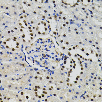 GTF2I / TFII I Antibody - Immunohistochemistry of paraffin-embedded rat kidney tissue.