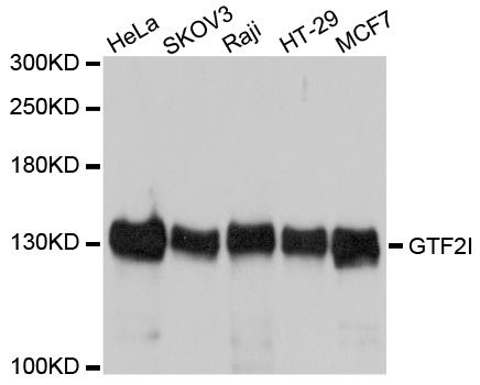 GTF2I / TFII I Antibody - Western blot analysis of extracts of various cell lines, using GTF2I antibody at 1:1000 dilution. The secondary antibody used was an HRP Goat Anti-Rabbit IgG (H+L) at 1:10000 dilution. Lysates were loaded 25ug per lane and 3% nonfat dry milk in TBST was used for blocking. An ECL Kit was used for detection and the exposure time was 1s.