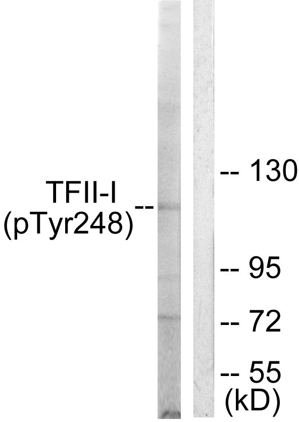 GTF2I / TFII I Antibody - Western blot analysis of lysates from LOVO cells, using TFII-I (Phospho-Tyr248) Antibody. The lane on the right is blocked with the phospho peptide.