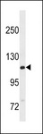 GTF2IRD2B Antibody - GTF2IRD2B Antibody western blot of A549 cell line lysates (35 ug/lane). The GTF2IRD2B antibody detected the GTF2IRD2B protein (arrow).