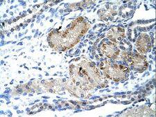 GTF3 / GTF2IRD1 Antibody - GTF2IRD1 antibody ARP33735_T100-NP_057412-GTF2IRD1(GTF2I repeat domain containing 1) Antibody was used in IHC to stain formalin-fixed, paraffin-embedded human kidney.  This image was taken for the unconjugated form of this product. Other forms have not been tested.