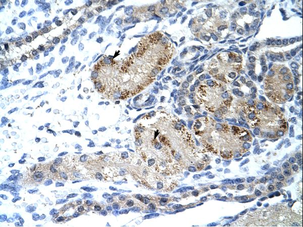 GTF3 / GTF2IRD1 Antibody - GTF2IRD1 antibody ARP33735_T100-NP_057412-GTF2IRD1(GTF2I repeat domain containing 1) Antibody was used in IHC to stain formalin-fixed, paraffin-embedded human kidney.  This image was taken for the unconjugated form of this product. Other forms have not been tested.