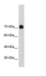 GTF3 / GTF2IRD1 Antibody - Transfected 293T Cell Lysate.  This image was taken for the unconjugated form of this product. Other forms have not been tested.