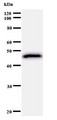 GTF3 / GTF2IRD1 Antibody - Western blot of immunized recombinant protein using GTF2IRD1 antibody.