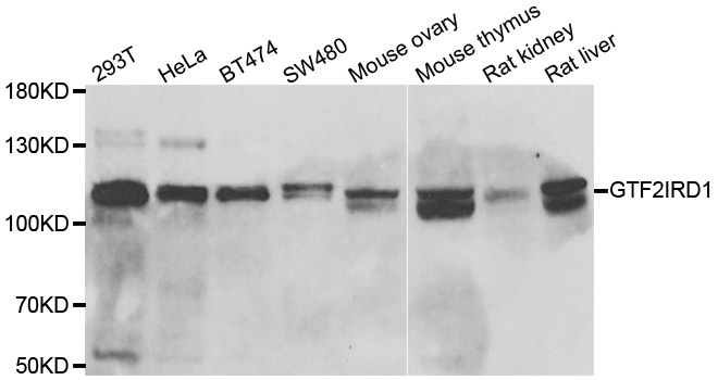 GTF3 / GTF2IRD1 Antibody - Western blot analysis of extracts of various cell lines.