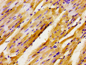 GTF3 / GTF2IRD1 Antibody - Immunohistochemistry image of paraffin-embedded human heart tissue at a dilution of 1:100
