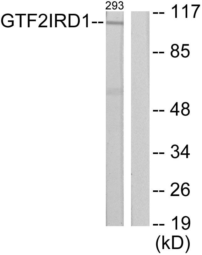 GTF3 / GTF2IRD1 Antibody - Western blot analysis of extracts from 293 cells, using GTF2IRD1 antibody.