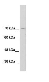 GTF3 / GTF2IRD1 Antibody - Transfected 293T Cell Lysate.  This image was taken for the unconjugated form of this product. Other forms have not been tested.