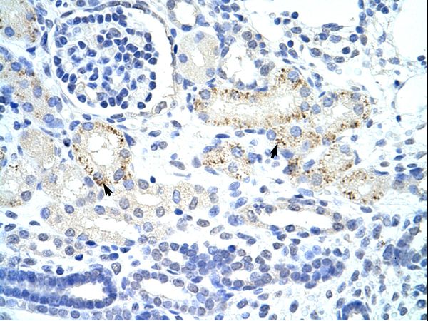 GTF3 / GTF2IRD1 Antibody - GTF2IRD1 antibody ARP39253_T100-NP_057412-GTF2IRD1(GTF2I repeat domain containing 1) Antibody was used in IHC to stain formalin-fixed, paraffin-embedded human kidney.  This image was taken for the unconjugated form of this product. Other forms have not been tested.