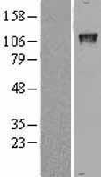 GTF3 / GTF2IRD1 Protein - Western validation with an anti-DDK antibody * L: Control HEK293 lysate R: Over-expression lysate