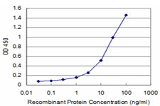 GTF3A Antibody - Detection limit for recombinant GST tagged GTF3A is approximately 0.3 ng/ml as a capture antibody.