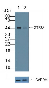 GTF3A Antibody - Knockout Varification: Lane 1: Wild-type Jurkat cell lysate; Lane 2: GTF3A knockout Jurkat cell lysate; Predicted MW: 41,39kd Observed MW: 44kd Primary Ab: 1µg/ml Rabbit Anti-Human GTF3A Antibody Second Ab: 0.2µg/mL HRP-Linked Caprine Anti-Rabbit IgG Polyclonal Antibody