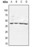 GTF3A Antibody - Western blot analysis of GTF3A expression in A549 (A), COS7 (B), PC12 (C), AML12 (D) whole cell lysates.