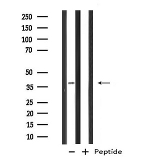 GTF3A Antibody - Western blot analysis of extracts of Jurkat cells using GTF3A antibody.