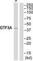 GTF3A Antibody - Western blot analysis of extracts from Jurkat cells, using GTF3A antibody.