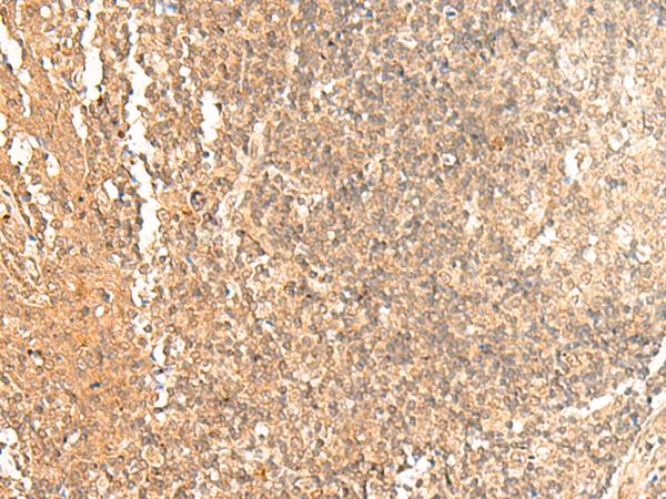GTF3A Antibody - Immunohistochemistry of paraffin-embedded Human tonsil tissue  using GTF3A Polyclonal Antibody at dilution of 1:60(×200)