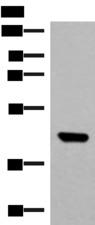 GTF3A Antibody - Western blot analysis of TM4 cell lysate  using GTF3A Polyclonal Antibody at dilution of 1:550