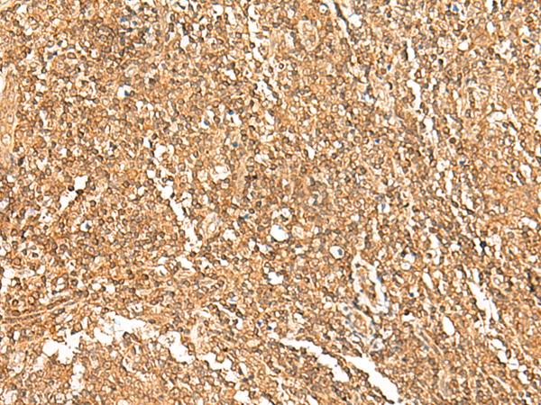 GTF3A Antibody - Immunohistochemistry of paraffin-embedded Human tonsil tissue  using GTF3A Polyclonal Antibody at dilution of 1:75(×200)