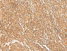 GTF3A Antibody - Immunohistochemistry of paraffin-embedded Human tonsil tissue  using GTF3A Polyclonal Antibody at dilution of 1:75(×200)
