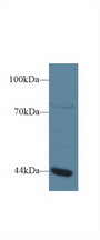 GTF3A Antibody - Western Blot; Sample: Human Jurkat cell lysate; Primary Ab: 1µg/ml Rabbit Anti-Human GTF3A Antibody Second Ab: 0.2µg/mL HRP-Linked Caprine Anti-Rabbit IgG Polyclonal Antibody