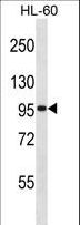 GTF3C2 Antibody - GTF3C2 Antibody western blot of HL-60 cell line lysates (35 ug/lane). The GTF3C2 antibody detected the GTF3C2 protein (arrow).