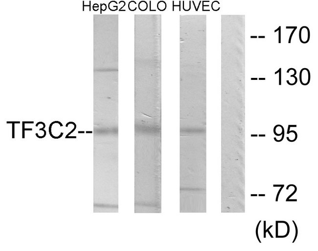 GTF3C2 Antibody - Western blot analysis of lysates from HepG2, COLO205, and HUVEC cells, using TF3C2 Antibody. The lane on the right is blocked with the synthesized peptide.