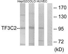 GTF3C2 Antibody - Western blot analysis of lysates from HepG2, COLO205, and HUVEC cells, using TF3C2 Antibody. The lane on the right is blocked with the synthesized peptide.