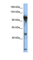 GTF3C2 Antibody - GTF3C2 antibody Western blot of Transfected 293T cell lysate. This image was taken for the unconjugated form of this product. Other forms have not been tested.