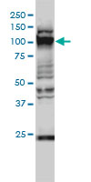 GTF3C2 Antibody - GTF3C2 monoclonal antibody (M01), clone 1C6-2B8 Western blot of GTF3C2 expression in HeLa NE.