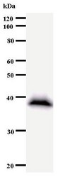 GTF3C2 Antibody - Western blot of immunized recombinant protein using GTF3C2 antibody.