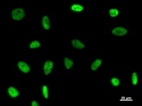 GTF3C2 Antibody - Immunostaining analysis in HeLa cells. HeLa cells were fixed with 4% paraformaldehyde and permeabilized with 0.1% Triton X-100 in PBS. The cells were immunostained with anti-GTF3C2 mAb.