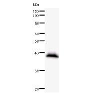 GTF3C2 Antibody - Western blot analysis of immunized recombinant protein, using anti-GTF3C2 monoclonal antibody.