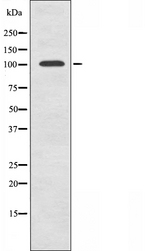 GTF3C2 Antibody - Western blot analysis of extracts of HepG2 cells using TF3C2 antibody.