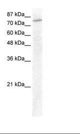 GTF3C3 Antibody - HepG2 Cell Lysate.  This image was taken for the unconjugated form of this product. Other forms have not been tested.