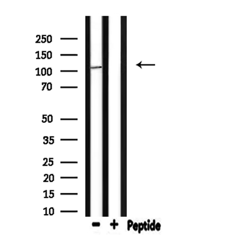 GTF3C3 Antibody - Western blot analysis of extracts of 293 cells using TF3C3 antibody. Lane 1 was treated with the blocking peptide.