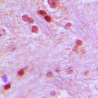 GTF3C3 Antibody - Immunohistochemical analysis of GTF3C3 staining in human brain formalin fixed paraffin embedded tissue section. The section was pre-treated using heat mediated antigen retrieval with sodium citrate buffer (pH 6.0). The section was then incubated with the antibody at room temperature and detected using an HRP conjugated compact polymer system. DAB was used as the chromogen. The section was then counterstained with hematoxylin and mounted with DPX.