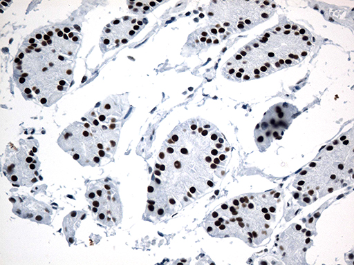 GTF3C4 Antibody - Immunohistochemical staining of paraffin-embedded Human gastric tissue within the normal limits using anti-GTF3C4 mouse monoclonal antibody. (Heat-induced epitope retrieval by 1mM EDTA in 10mM Tris buffer. (pH8.5) at 120°C for 3 min. (1:500)