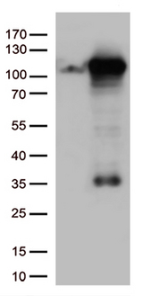 GTF3C4 Antibody - HEK293T cells were transfected with the pCMV6-ENTRY control. (Left lane) or pCMV6-ENTRY GTF3C4. (Right lane) cDNA for 48 hrs and lysed. Equivalent amounts of cell lysates. (5 ug per lane) were separated by SDS-PAGE and immunoblotted with anti-GTF3C4. (1:500)
