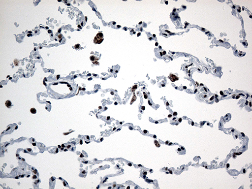 GTF3C4 Antibody - Immunohistochemical staining of paraffin-embedded Human lung tissue within the normal limits using anti-GTF3C4 mouse monoclonal antibody. (Heat-induced epitope retrieval by 1mM EDTA in 10mM Tris buffer. (pH8.5) at 120°C for 3 min. (1:500)